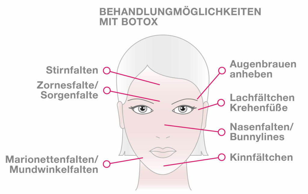 BOTULINUMTOXIN (BOTOX®) Faltenbehandlung Zürich