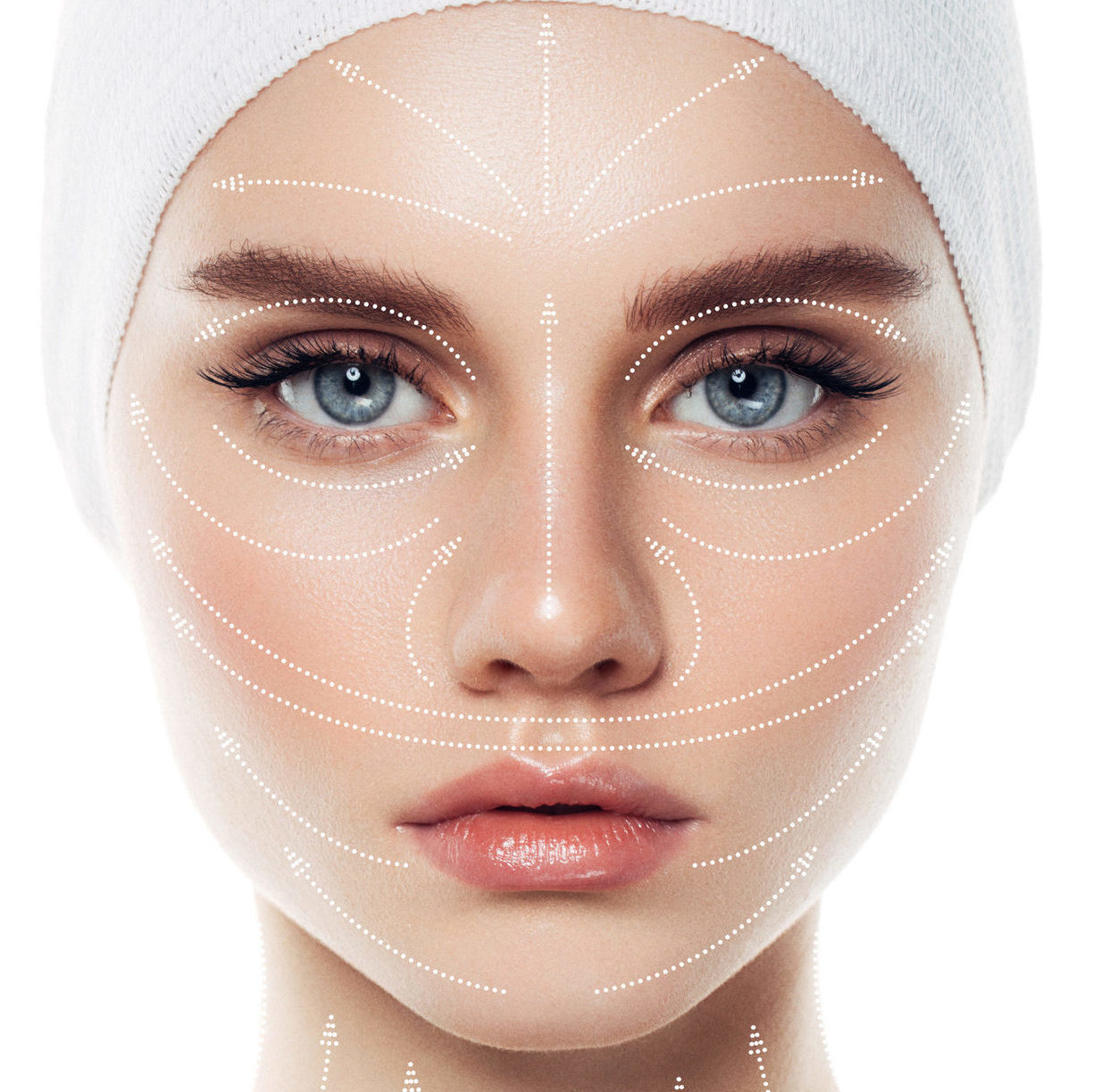 Fadenlifting Zürich