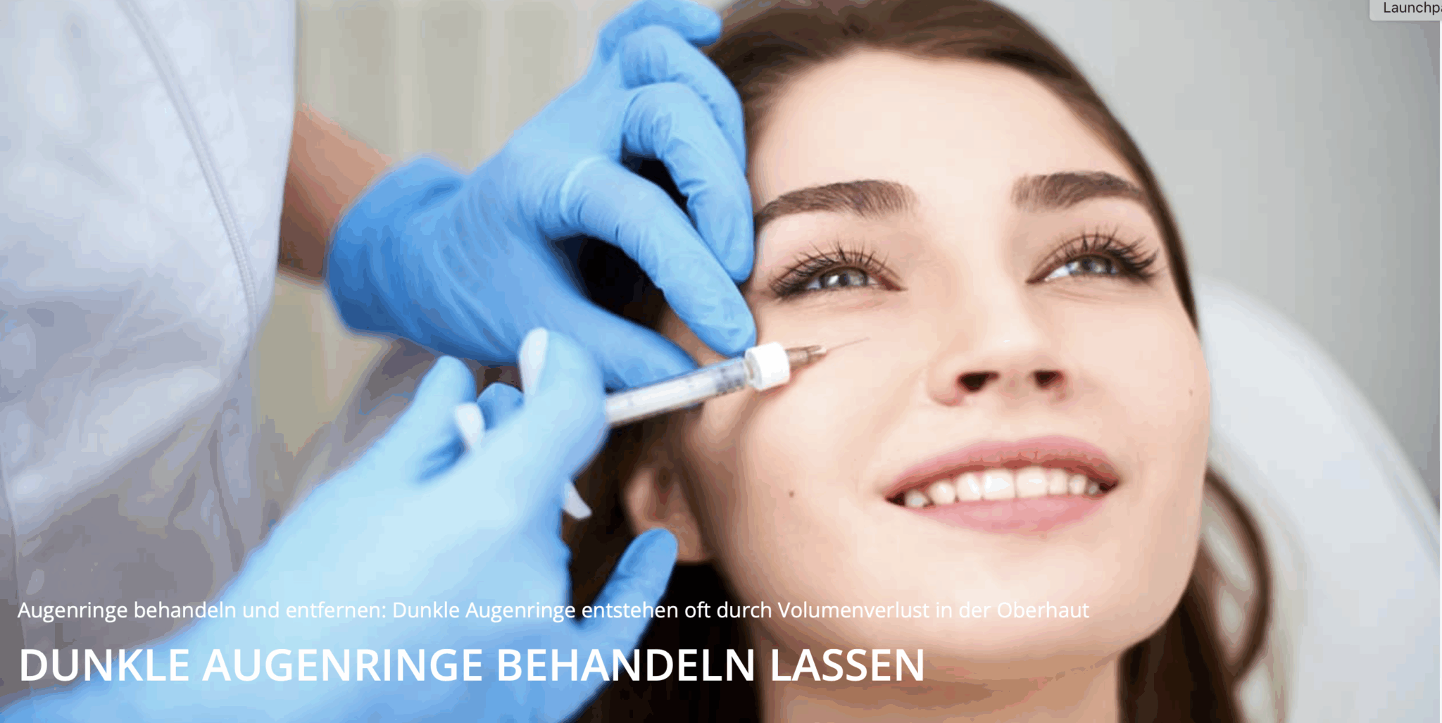 Augenringe Zürich