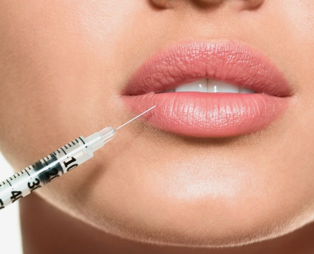 Details zu Techniken Lippen aufspritzen Zürich